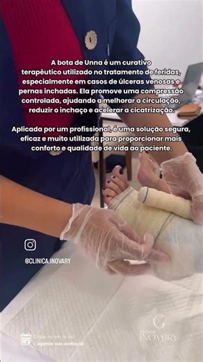 A bota de Unna é um curativo terapêutico utilizado no tratamento