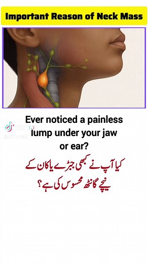 Understanding Swollen Neck Lymph Nodes Causes