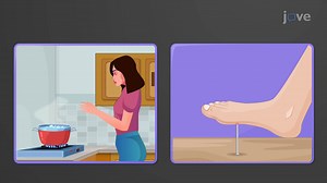 Video: Reflex Activity