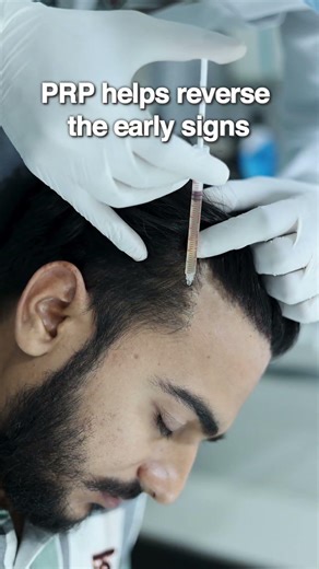 Stop Hair Fall Fast with PRP Treatment | Real Results #dermatology #haircare