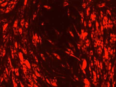 Wound healing with CellTracker™ Red