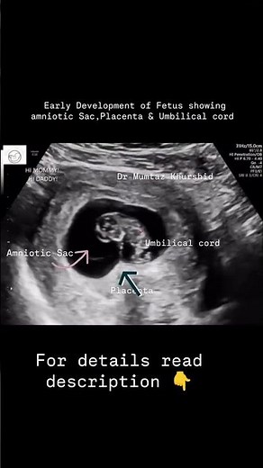 Early months Pregnancy Development of Baby