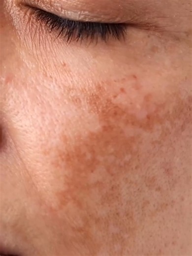 Essential Solutions for Every Skin Type