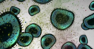 The girl whose T cells beat cancer