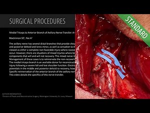 Medial Triceps to Axillary Nerve Transfer: Specific Reinnervation - Standard (Feat. Dr. Mackinnon) • Video • MEDtube.net