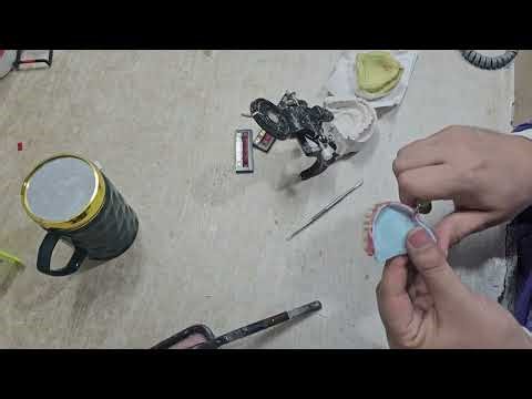 Removable prosthesis setup from start to finish#RemovableProsthesis#DentalLab#DentalTechnician#Art