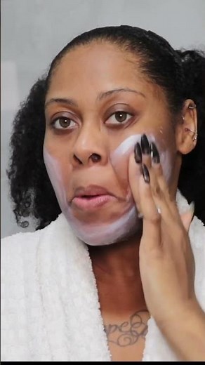 SUDOCREM ON HYPERPIGMENTATION ??? Real results #hyperpigmentation #skincare #skincareroutine