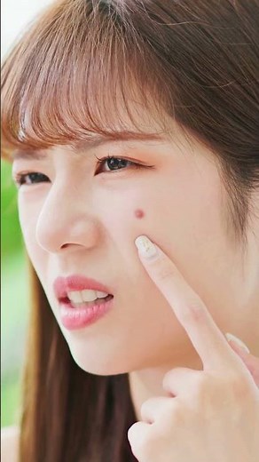 7 Surprising Home Remedies That Will CLEAR Your Acne FAST
