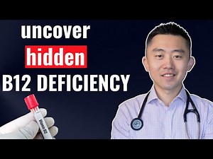 Why Your B12 Test Doesn’t Match Your Symptoms (Fatigue, Neuropathy, Brain Fog, Memory Loss)