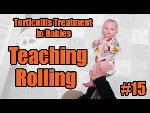 #15 Teaching Rolling: Torticollis Treatment in Babies