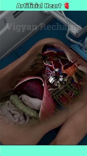 How Engineers Built a Heart That Actually Works #innovation #science