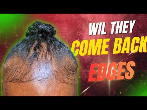 📈 Edge Regrowth Journey: My REAL truth about hair loss and the simple plan I used to grow it back