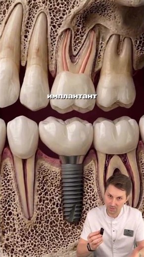 What happens to you after a tooth extraction? #dentist #dentistry #smile #health #doctor #extraction