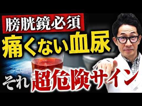 【膀胱がん】痛くない血尿は要注意！膀胱鏡が必要な症状と検査の流れを泌尿器科医が解説