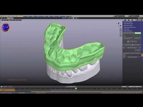 Splint Designer - HD 1080p