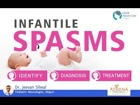 INFANTILE SPASMS: SYMPTOMS, DIAGNOSIS AND TREATMENT