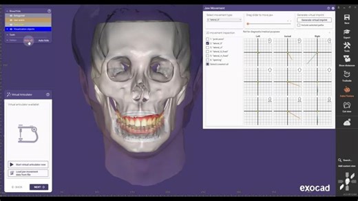 Seamless Workflow: RAYFace to exocad Integration with Dynamic Occlusion | Daewoo Kim