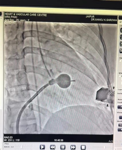 Dr. Manoj K. Sarowa - Cardiologist on Reels