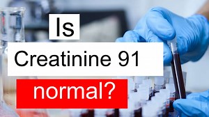 Is Serum Creatinine 91 normal, high or low? What does Serum Creatinine level 91 mean?
