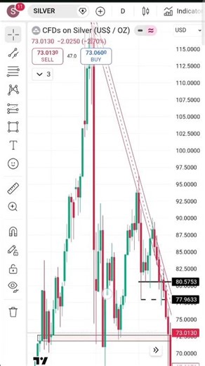 Basics of technical analysis 👏 | technical trading beginners 💸 #trading #investing #sho rts