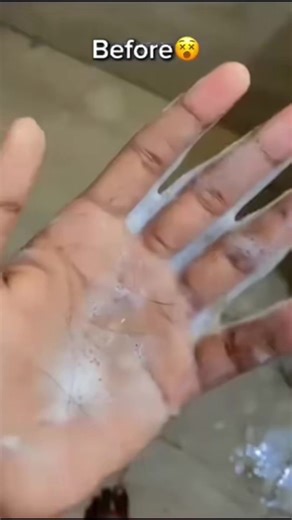 Effective Hair Fall Solutions for Daily Routine