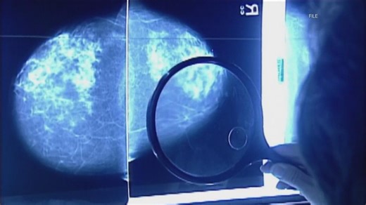 There's another gene mutation that increases risk of developing breast cancer