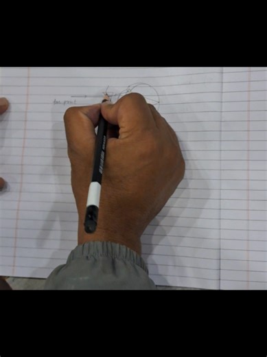 Correcting Short Sightedness: Effective Vision Solutions