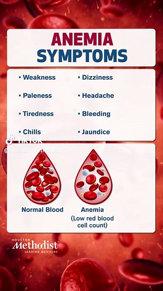 Understanding Anemia: Symptoms and Management