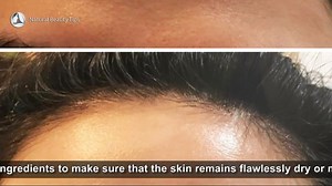 8.7K views · 159 reactions | EASY FACE WASH FOR OILY SKIN (1) | Natural Beauty Tips | Facebook