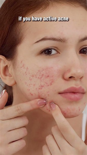 3 serums for your skincare routine| Best serum combinations|