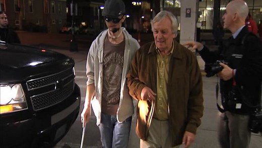 Dallas Wiens Face Transplant Footage