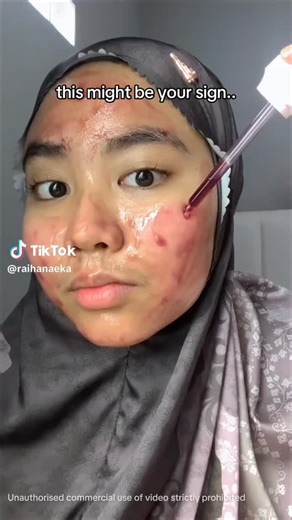 Hesty Agen Msglow Madiun | THIS IS IT, MAXI SILK DARI MS GLOW ✨ MS Glow kembali menghadirkan inovasi skincare terbaik dengan dua produk yang hadir untuk membantu... | Instagram
