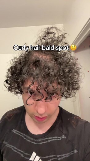 @hairsnap_app with them rating, my hair isn’t that bad #fyp #curls #curlyhair #balding #routine