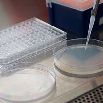 Imaging Mycobacterium tuberculosis in Mice with Reporter Enzyme Fluorescence