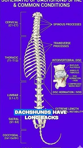The #1 Mistake That Increases Back Risk