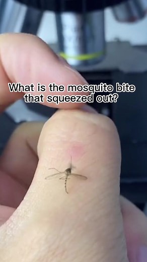 Why you don’t like mosquito? Here is the reason 😲😲😲😲#mosquitos #bite #human #microscope #microscope666 #foryou #fyp #challenge #tiktok #tiktoker #scientist #science #blood #zoom #nature #finger