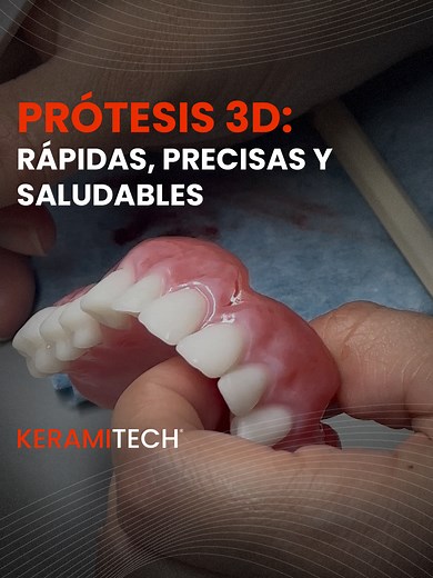 Elaboración de Prótesis Dentales en 3D