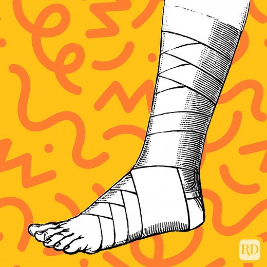 Where Did the Phrase "Break a Leg" Come From?