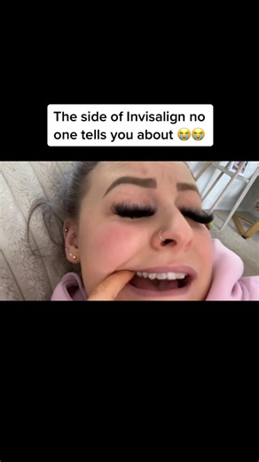 Invisalign Pain: The Side Effects No One Talks About