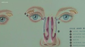 Sinus massages: An alternative way to relieve congestion