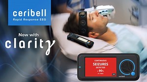 Portable, quick and accurate, Ceribell Rapid Response EEG is a new, leading-edge diagnostic tool that has transformed how clinicians at Cape Cod Hospital monitor and diagnose patients with non-convulsive seizures. To learn more about the Ceribell Rapid Response EEG system, visit: www.capecodhealth.org/ceribell | Cape Cod Healthcare | Facebook