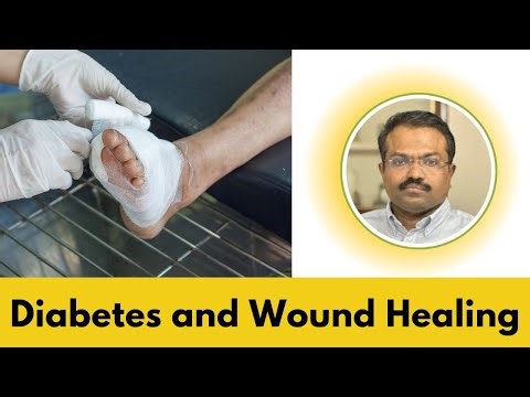 நீரிழிவு மற்றும் காயம் குணப்படுத்துதல் | நீரிழிவு நோயாளிகள் காயங்கள் இருக்கும்போது ஏன் கவனமாக இரு...