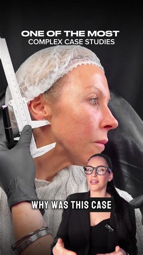 Jawline Injection Techniques After Surgery: Expert Insights