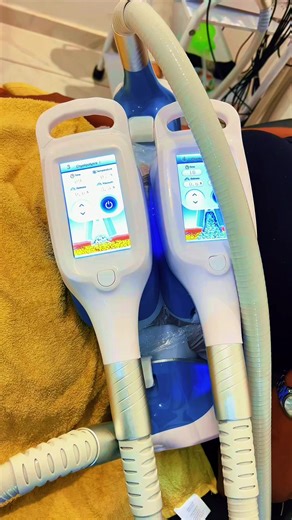 Fat Freeze session🥶 Fat freeze destroys fat cells using cold. Once the fat cells die, your lymphatic system treats them like waste and gradually removes them over time. They will be gone permanently from that area. Fat dissolving injections💉 Dissolve fat on injected areas. For best results: 3-5 sessions recommended. Book your session today! 📍Kloof Durban KZN WhatsApp 063 156 37 59 #fatfreeze #coolsculpting #fatdissolving #fatlossjourney #viral