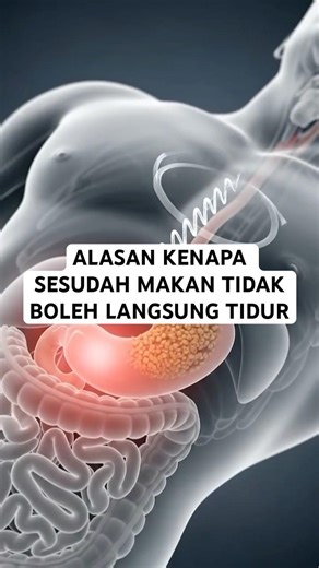 No no ya abis makan langsung tidur🫵🏻 #edukasikesehatan #edukasi #aieducation #tidursesudahmakan
