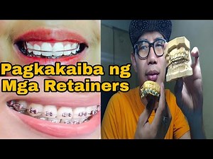 Different kinds of Retainers, Retainer like Braces with Gums, Pustiso/denture with Retainer designs.