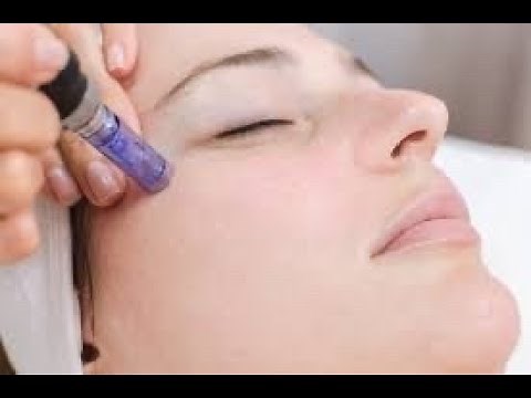MicroNeedling Training