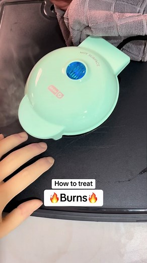 I burn 4 you 🫶 #medical #health #kitchen #cooking #emergency | 3rd degree burn