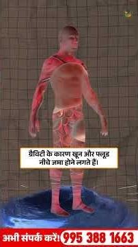 Varicose Veins Ya Venous Insufficiency? Symptoms & Causes