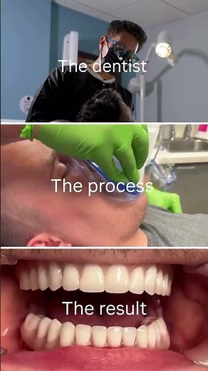The Secret Behind Every Beautiful Smile | Dental Implant Process Explained 🦷